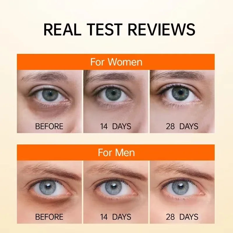 Suero Antiojeras