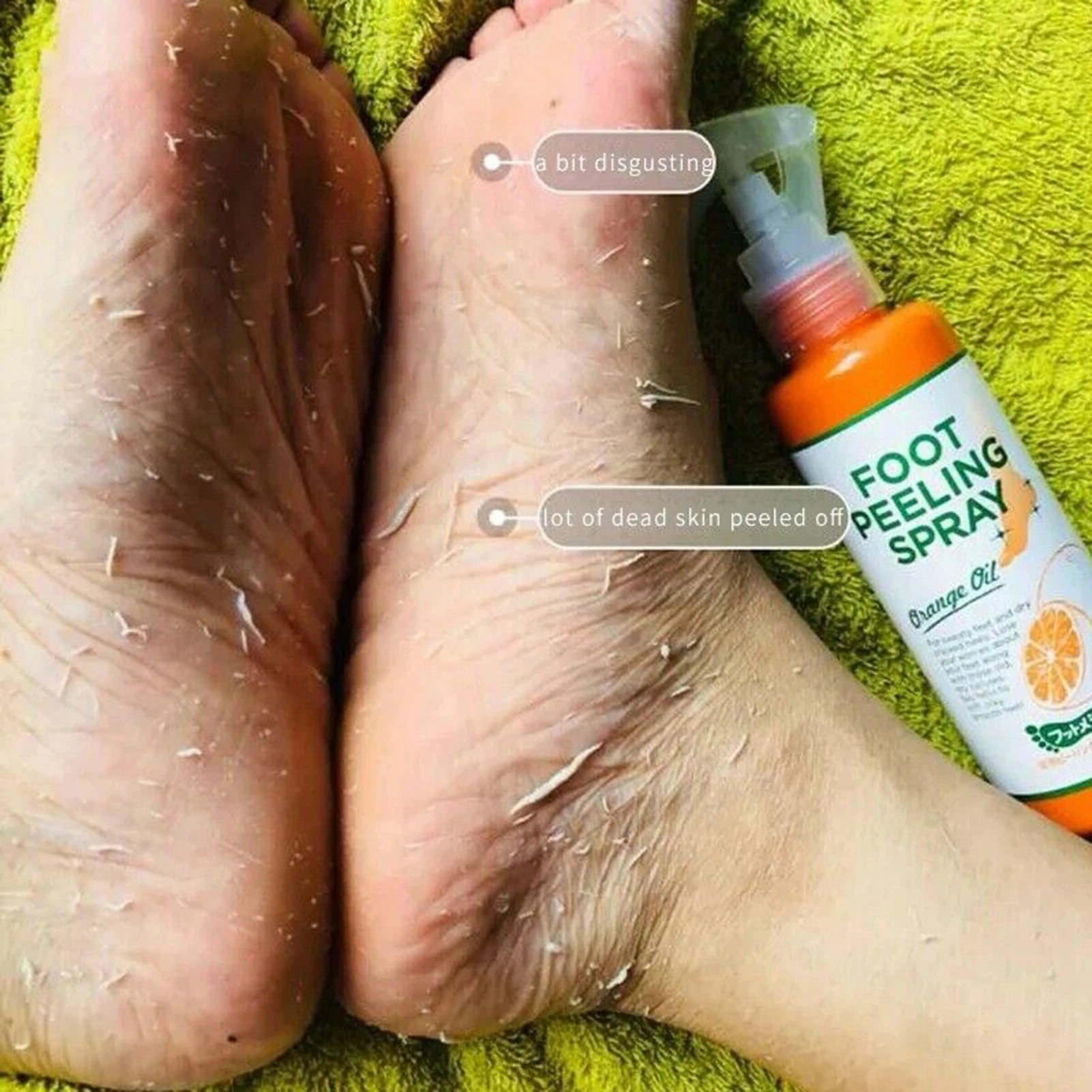Spray Exfoliante para Pies de 110 ml que Mejora la Piel Áspera