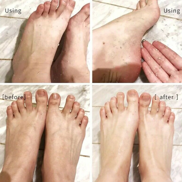 110ml Foot Exfoliating Spray Improves Rough Skin