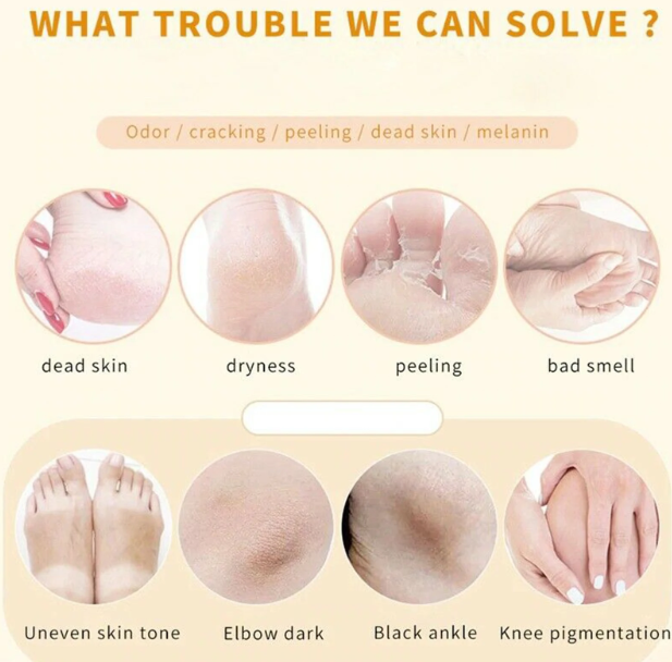 110ml Foot Exfoliating Spray Improves Rough Skin